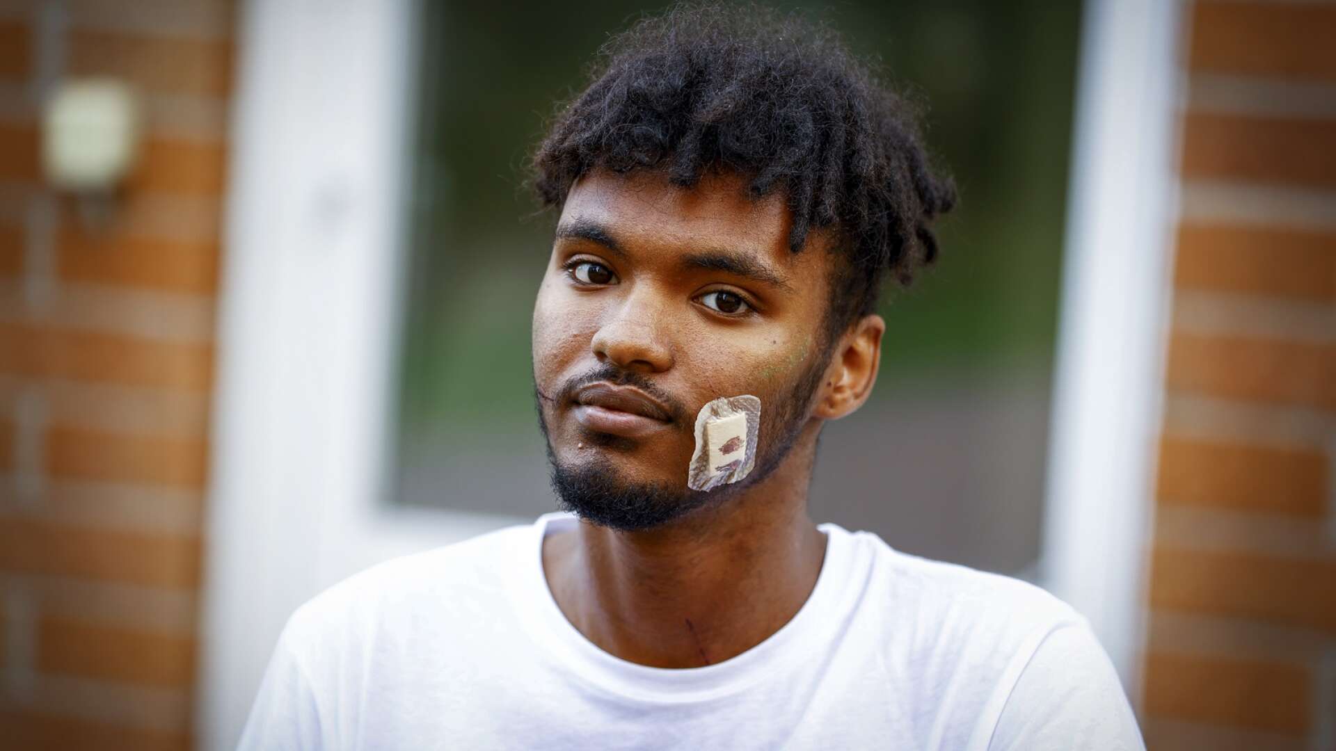 Studenten Abbe, 22, knivskars i ansiktet när flera personer överföll honom under nollningen i förra veckan.