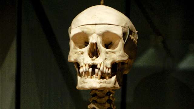 Ett mänskligt skelett tros ha hängt som utsmyckning i en skola. Dock inte det här skelettet./ARKIVBILD
