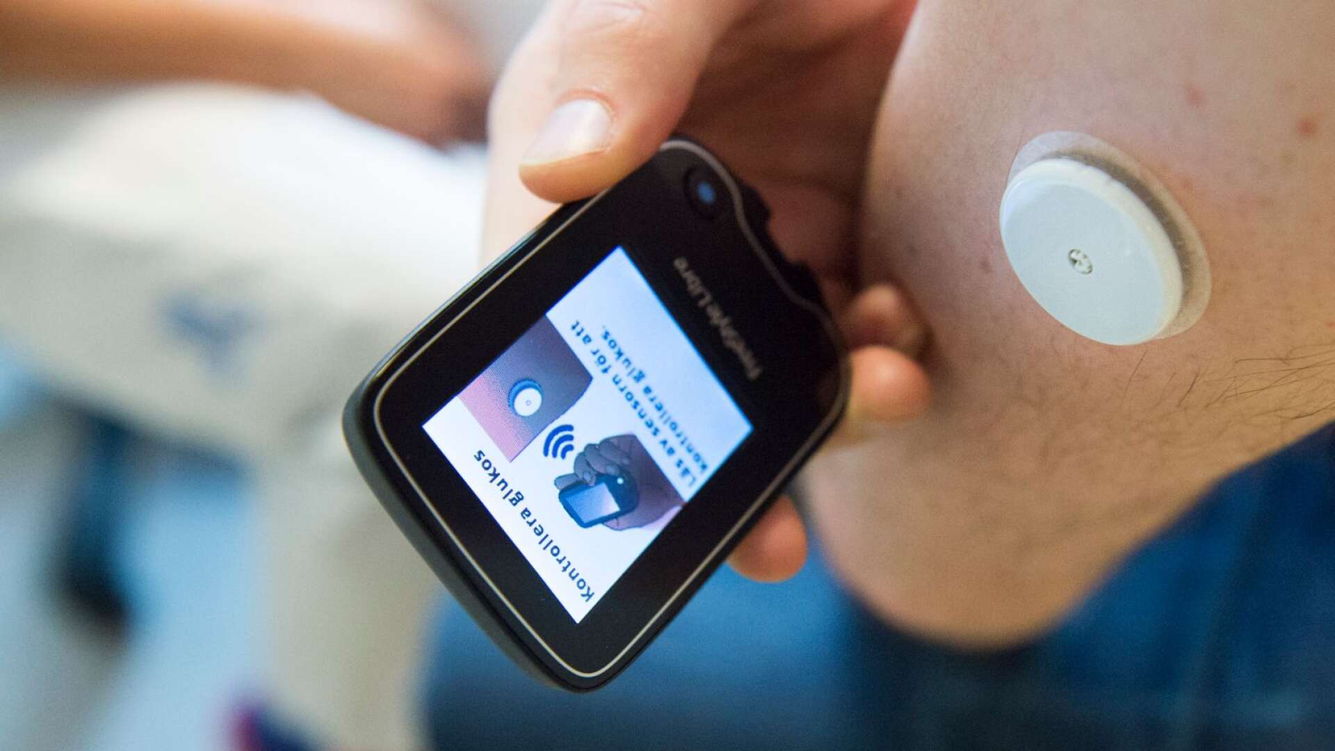Kontinuerlig mätning av blodsockret, till exempel genom en sensor på armen som mäter blodsockervärdet under hela dygnet ger bättre kontroll jämfört med att regelbundet sticka sig i fingret, skriver Örjan Arwidsson.