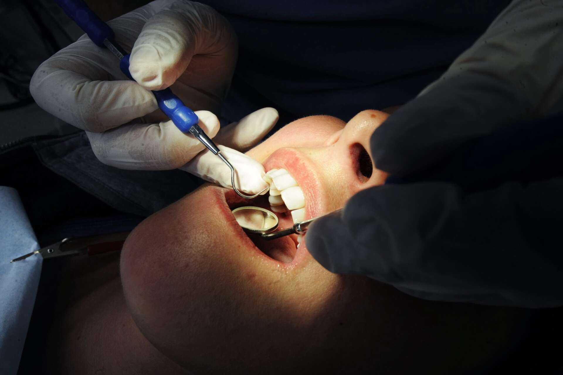 Regionstyrelsen föreslår att besluta att regionen ska lägga ner det tandtekniska laboratoriet Klaralab.