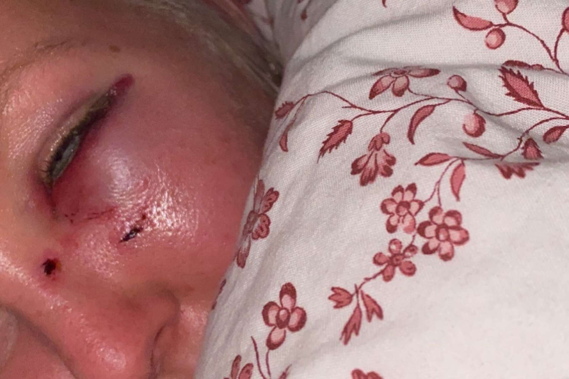Emma Persson, 21, fick en hjärnskakning när poliserna brottade ned henne. Hon polisanmälde dem men förundersökningen har lagts ned.