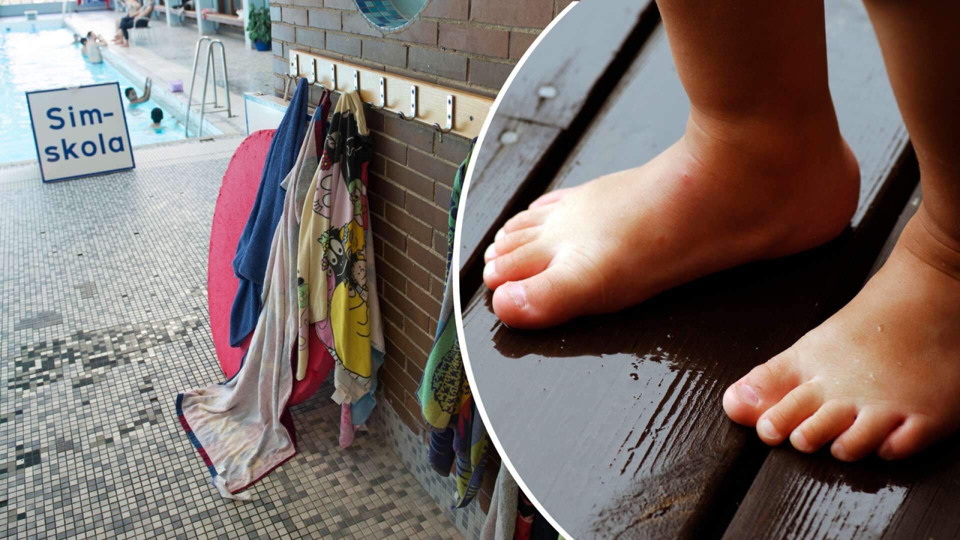 6-åriga Jasmine fick på nytt badhusfötter efter besök på Hagfors badhus. Fötterna på bilden har inget med själva händelsen att göra.