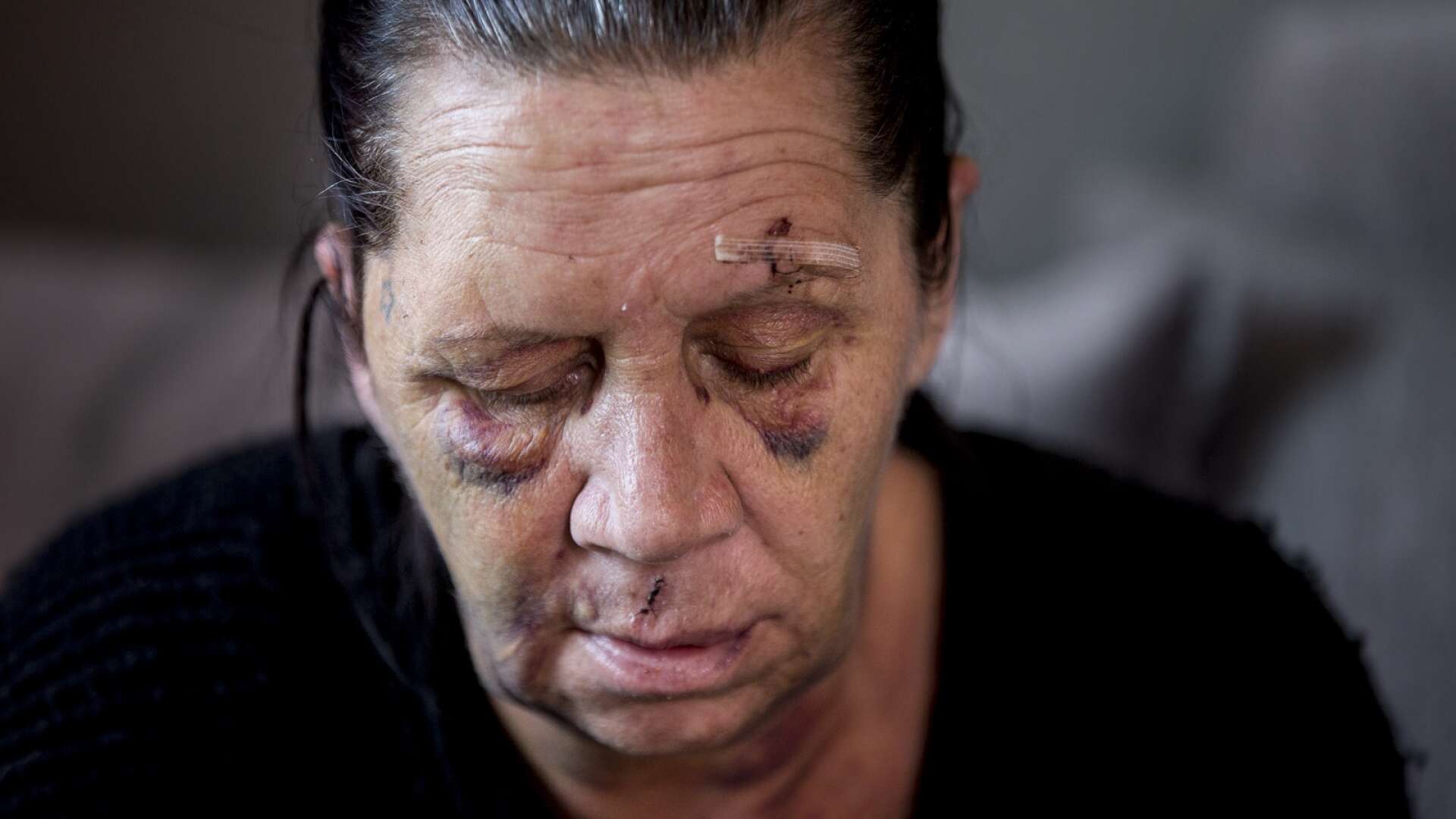 Den 18 april misshandlades Pernilla så grovt att hon fick frakturer på både näsbenet och ena käken. Nu döms hennes förövare.