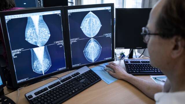 Mammografi räddar liv, men bara för de som faktiskt går på sin undersökning när de kallas.