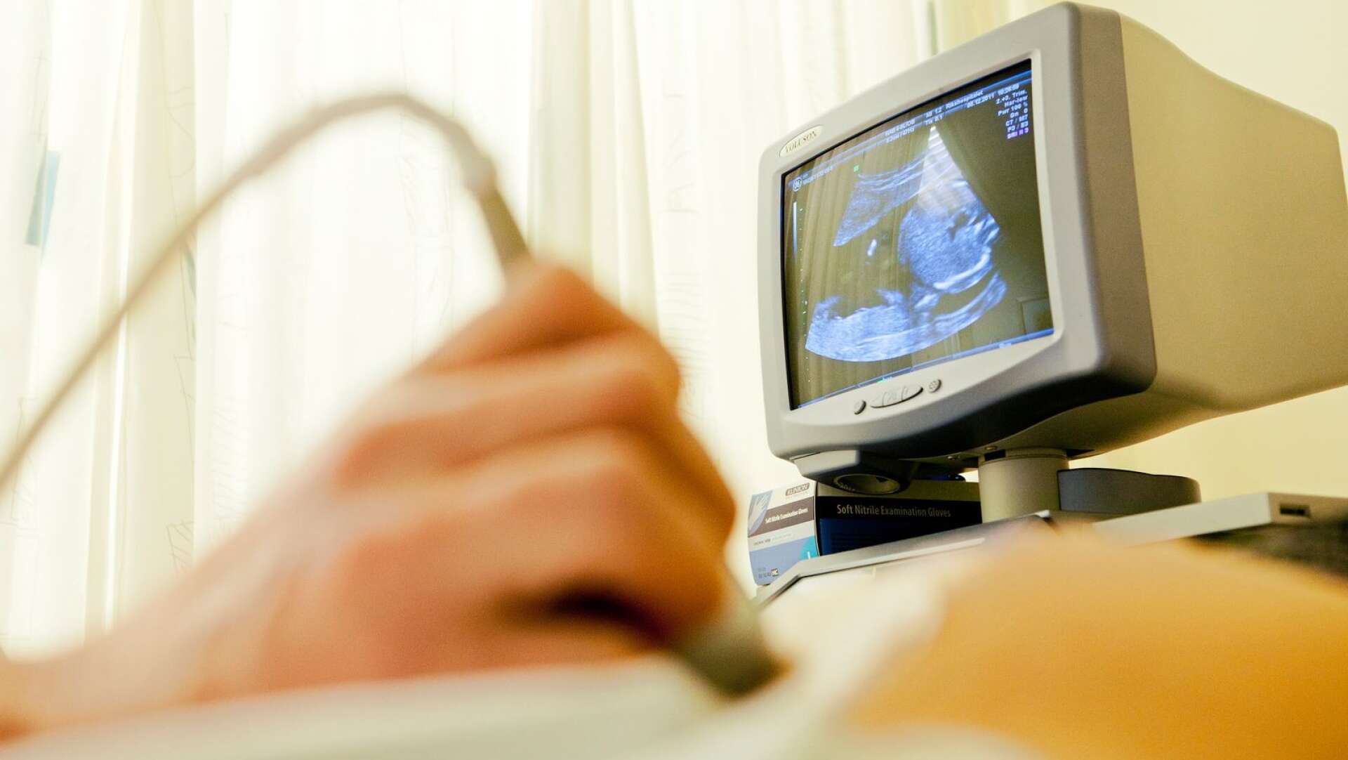 Barnmorskebrist gör att Region Värmland ställer in tidiga ultraljud under fem veckor kring årsskiftet.